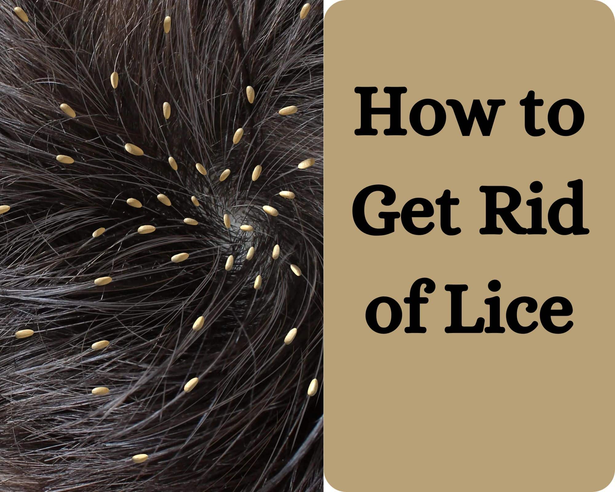 Symptoms Of Lice Infestation